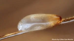 Close-up view of a louse(nit) egg on hair shaft