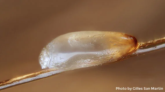Close-up view of a louse(nit) egg on hair shaft